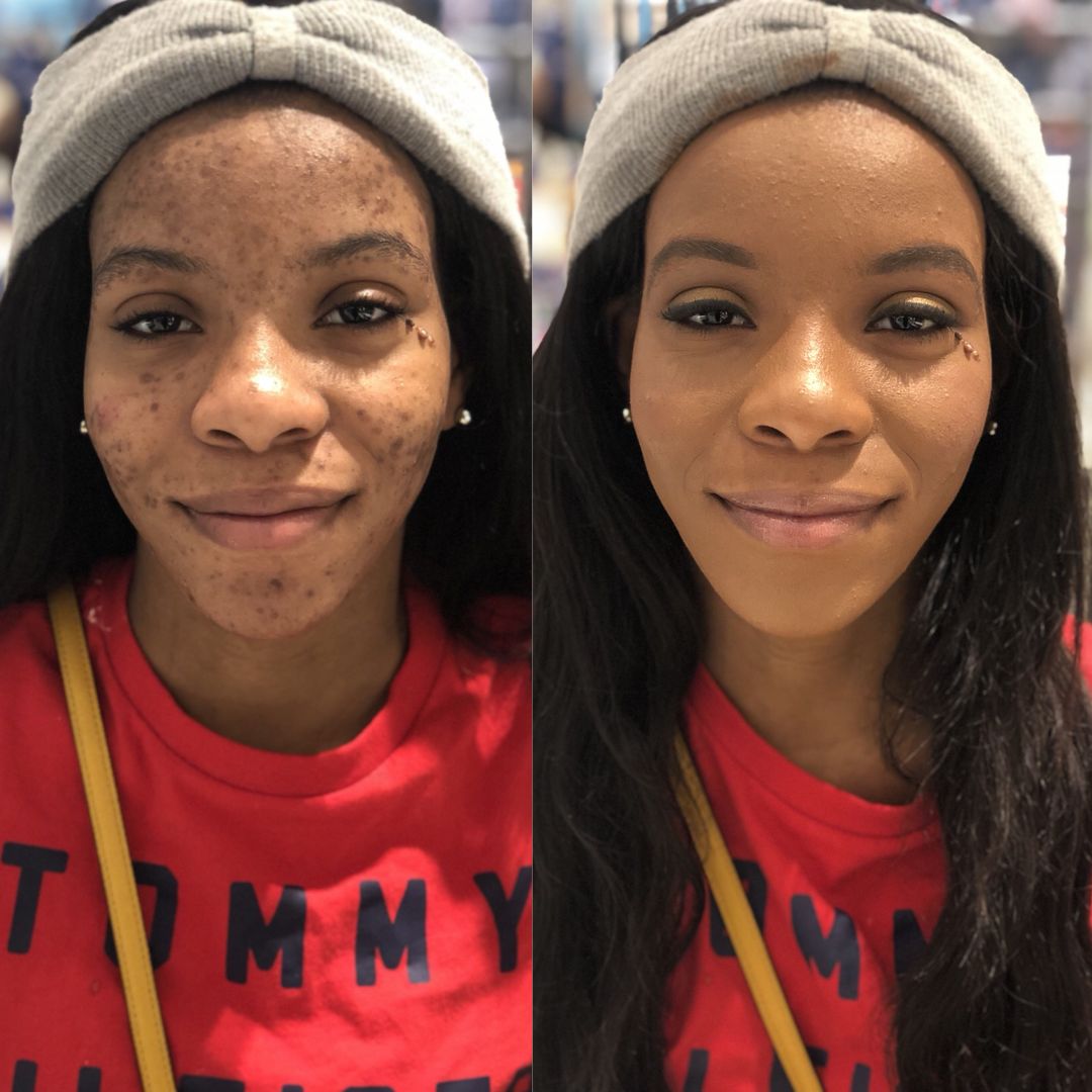 Radiance Repair Pads