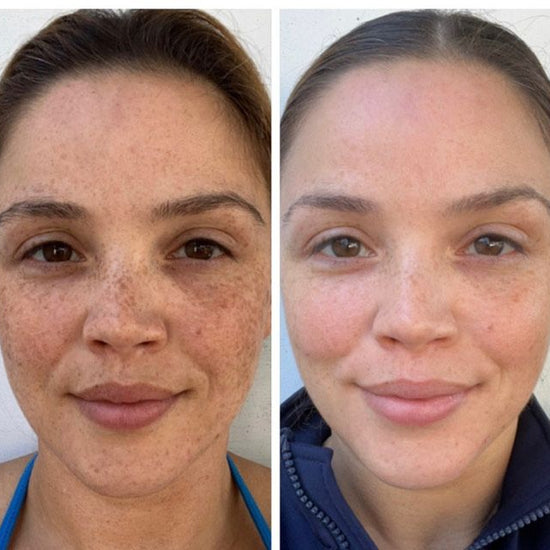 Radiance Repair Pads