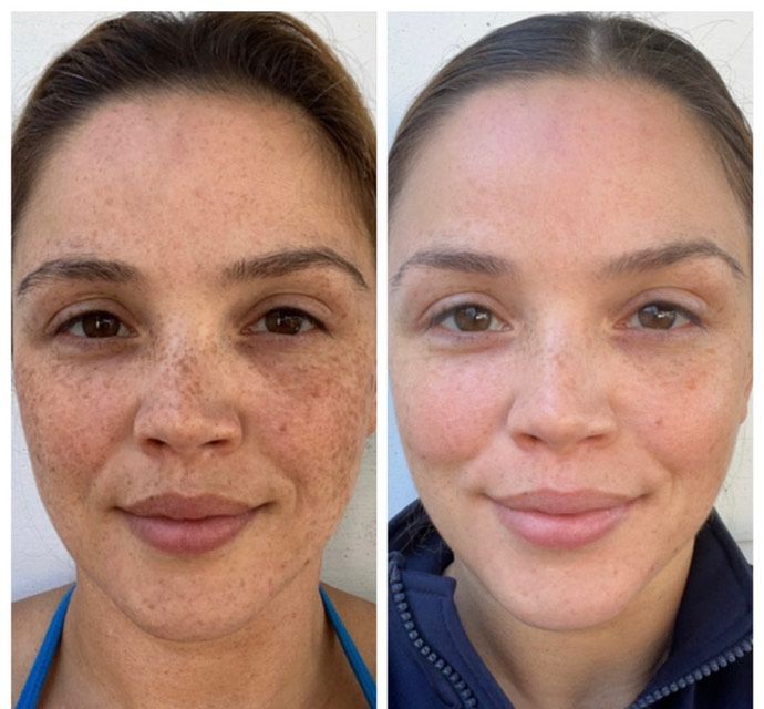 Radiance Repair Pads