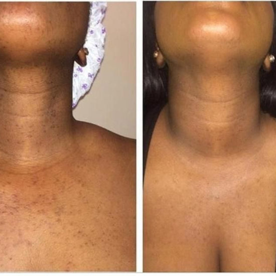 Radiance Repair Pads