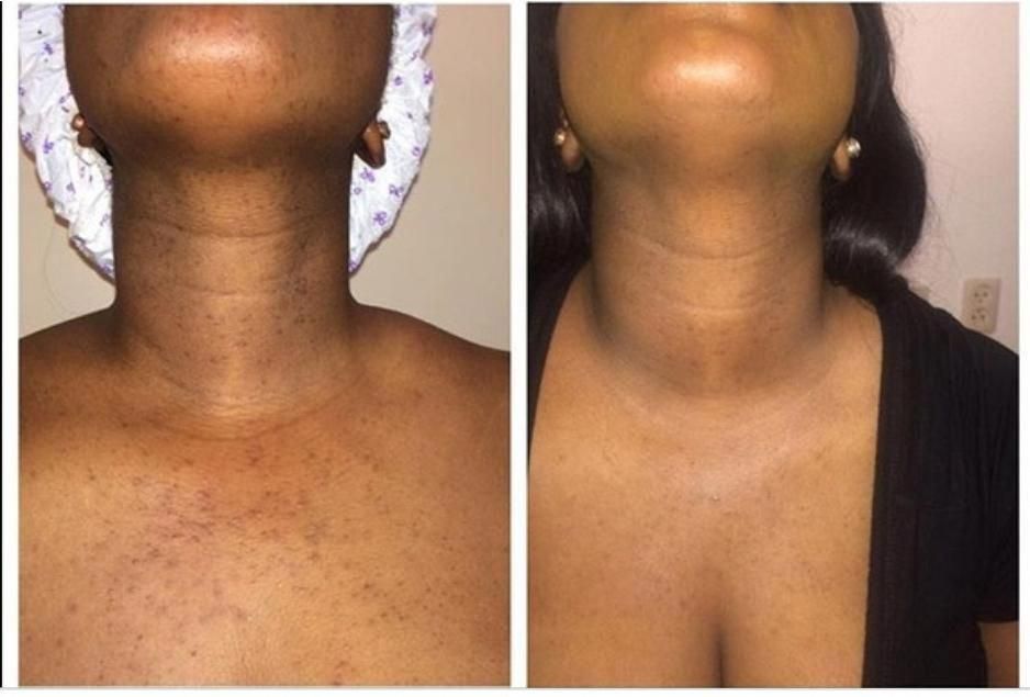 Radiance Repair Pads