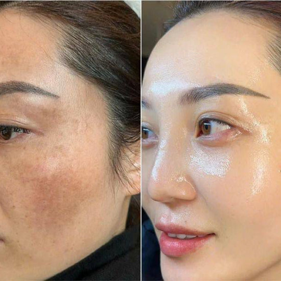 Radiance Repair Pads