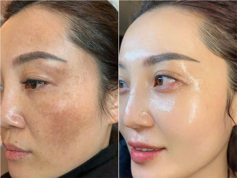 Radiance Repair Pads