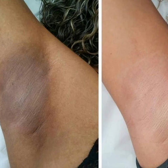 Radiance Repair Pads