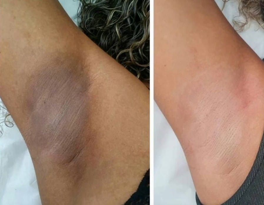 Radiance Repair Pads