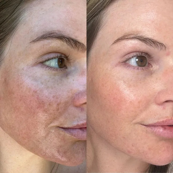 Radiance Repair Pads
