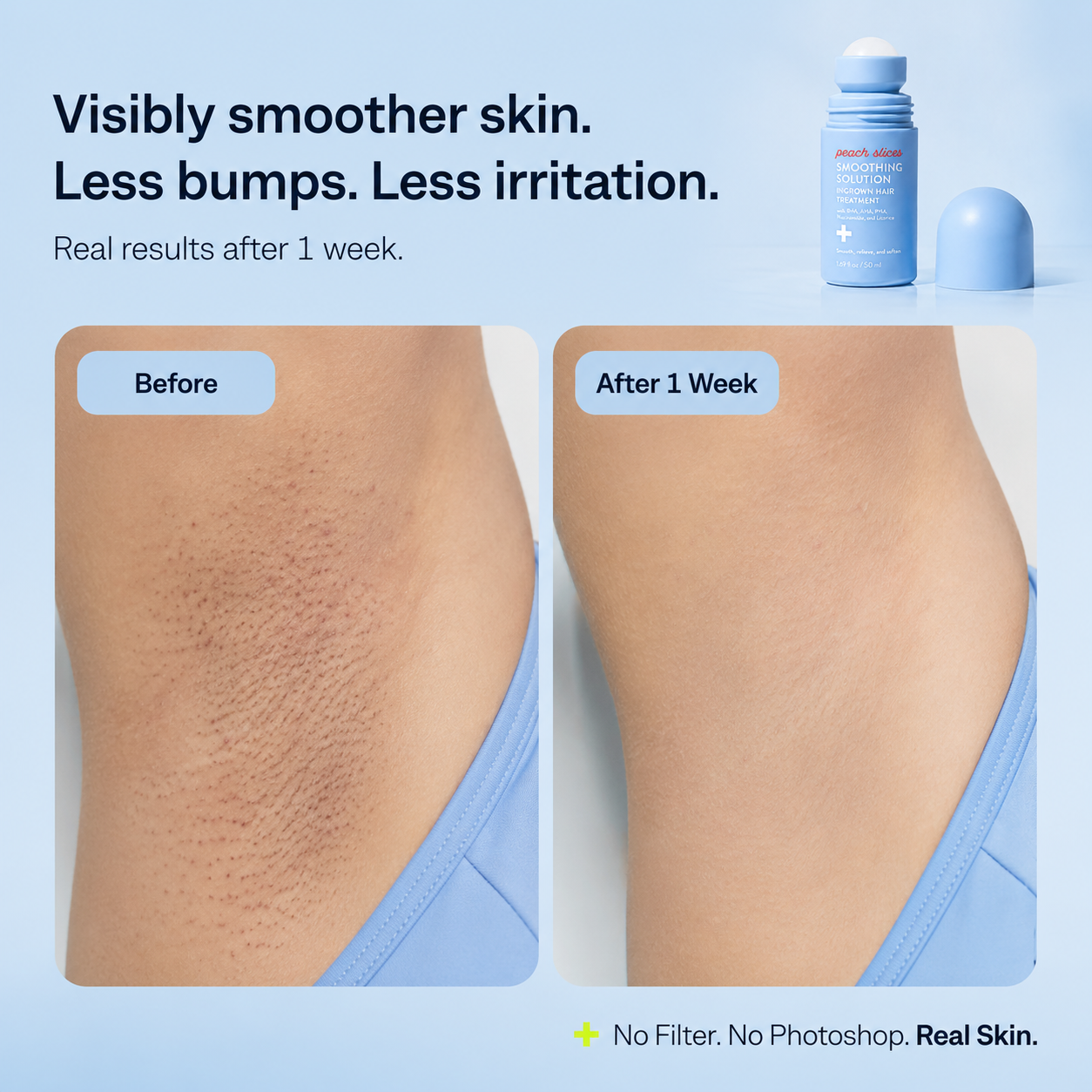 SmoothSkin Post-Shave Treatment Roller