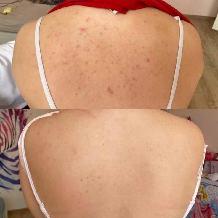 Radiance Repair Pads
